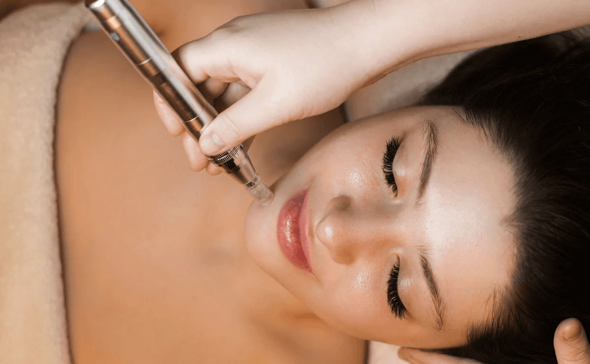 Microneedling Aftercare: The Expert Guide to Healing & Lasting Results - lefislaser