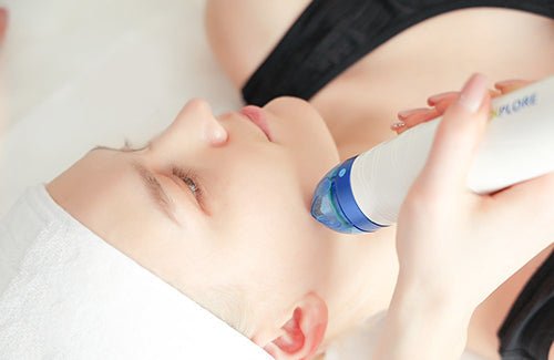 What are the advantages of microneedling? - lefislaser
