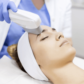 How to Get Rid of Freckles: Effective Treatments & Natural Tips - lefislaser