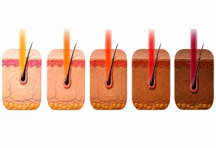 Five-Wavelength Technology