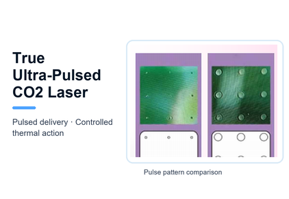 3. Ultra-Pulsed Delivery
