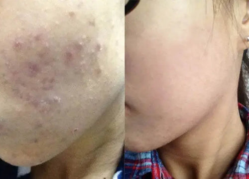 card_image