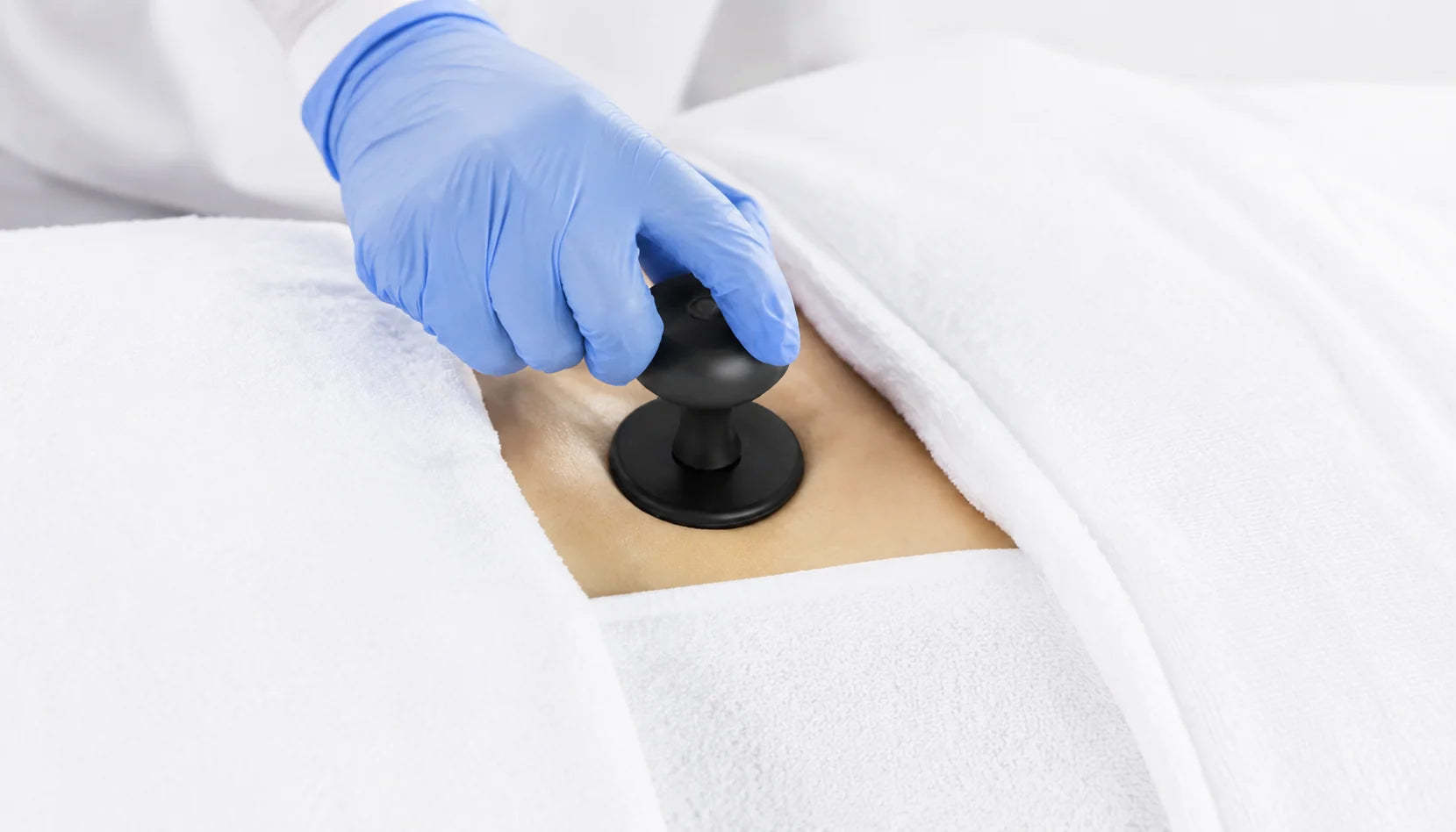 CET RF Body Treatment