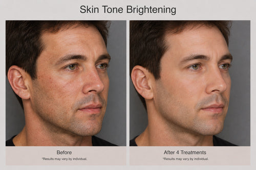 Skin Tone Brightening