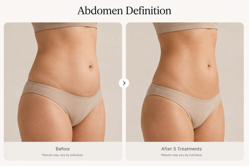 Case 1 — Abdomen Definition