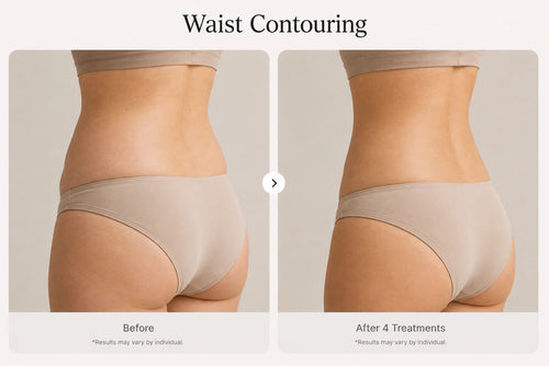 Case 2 — Waist Contouring