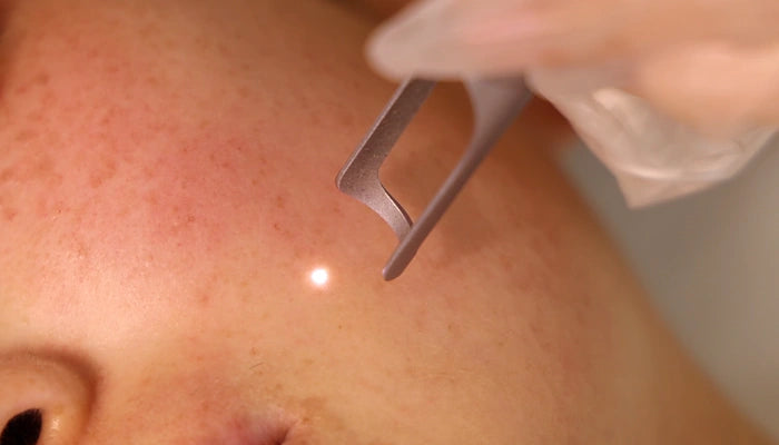 Treatment Settings and Operation