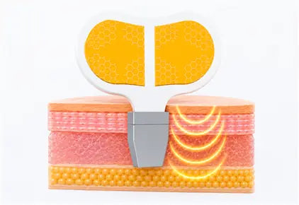 RF Energy Control